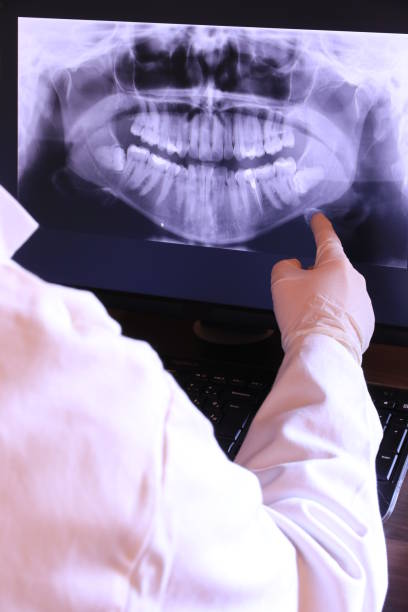 Best Emergency Root Canal Treatment in Columbia City, IN